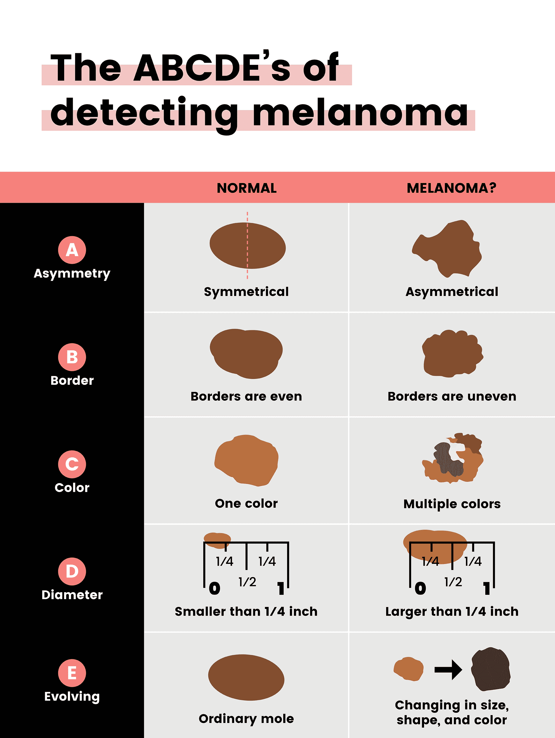 ABCDEs of Melanoma | The Treatment