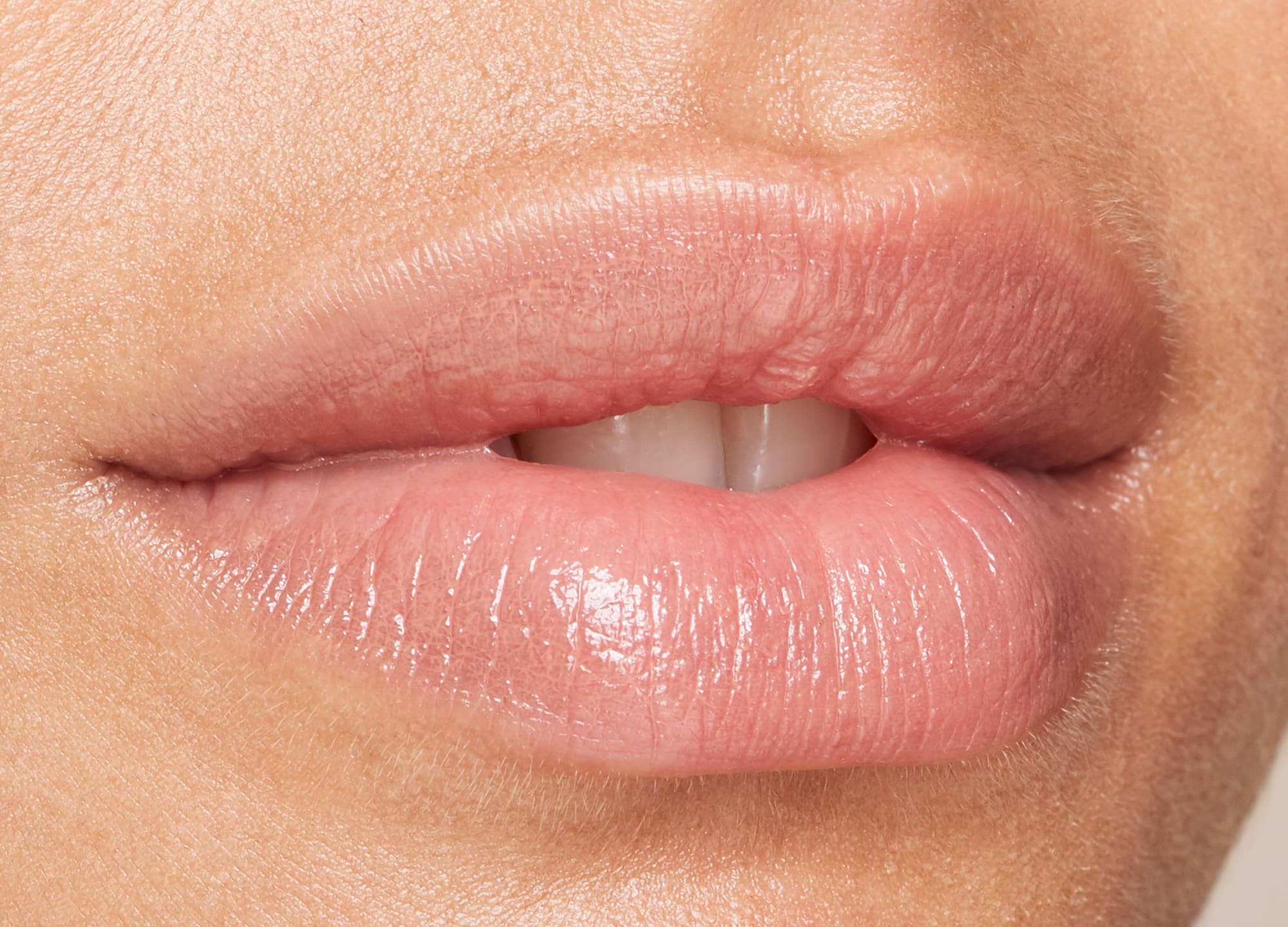 Tips to Make Your Lip Filler Last Longer: Choosing the Right Filler and  Post-Treatment Care