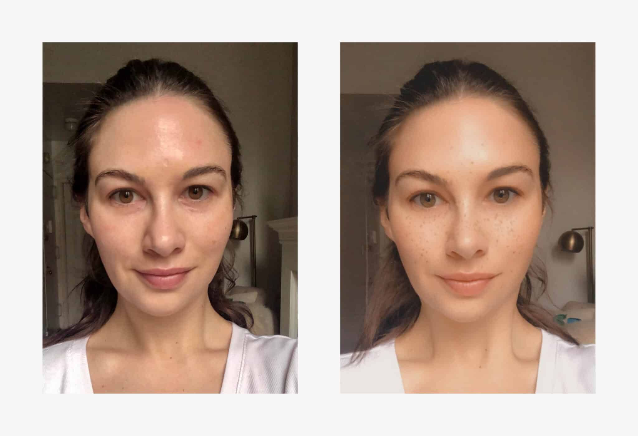 How 5 Photo Filters Perform Digital Surgery On Your Face RealSelf News