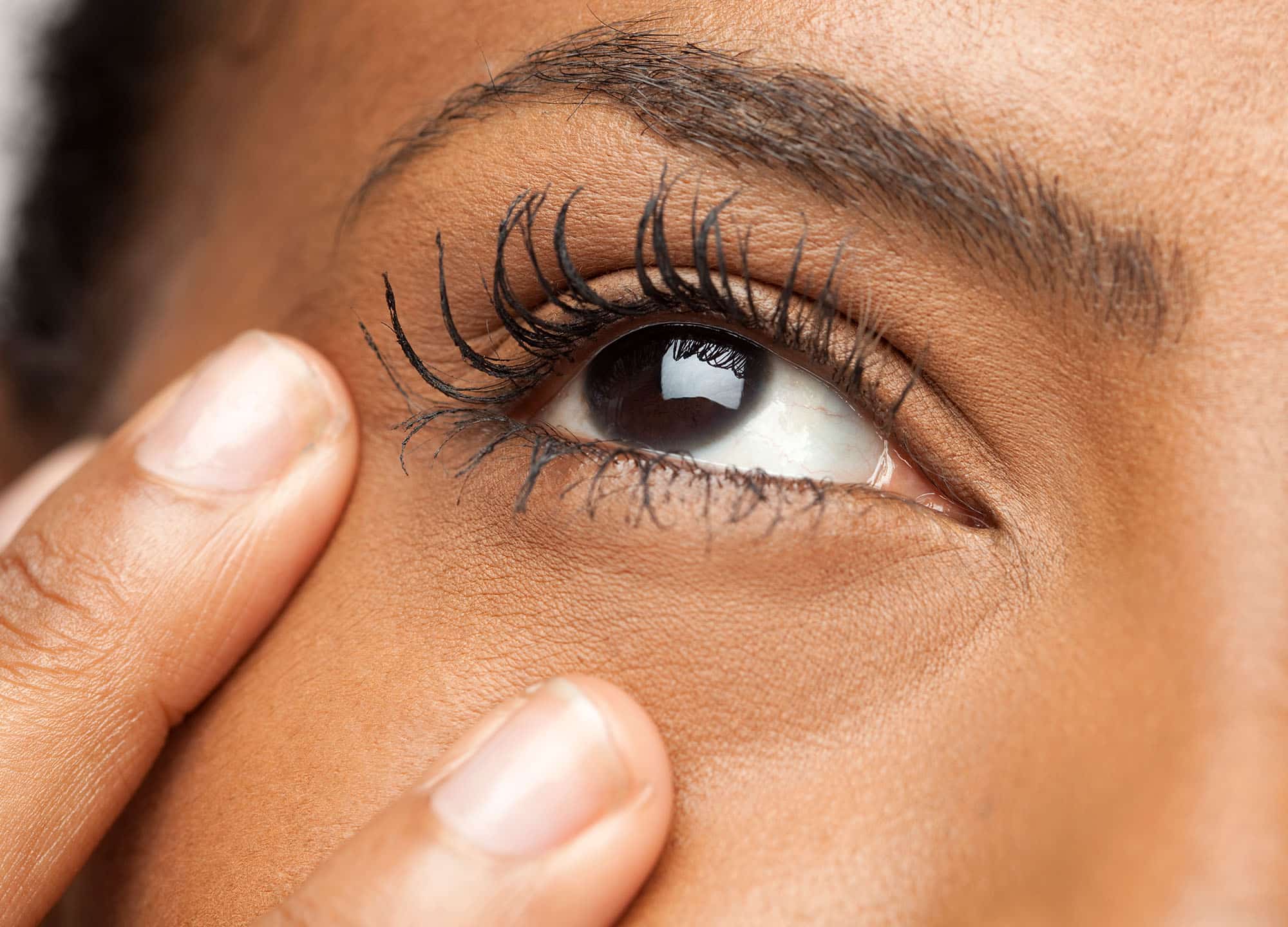 Puffy Eyes, Dark Circles, and Bags: Dermatologists Explain the Difference | Dark  eye circles, Puffy eyes, Remove dark circles