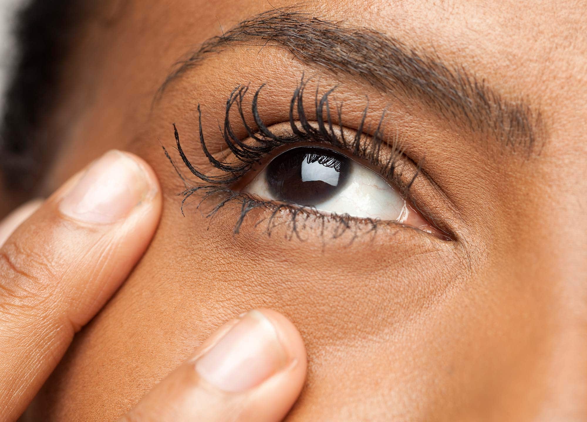 What Causes Puffy Eyes & How To Treat Them