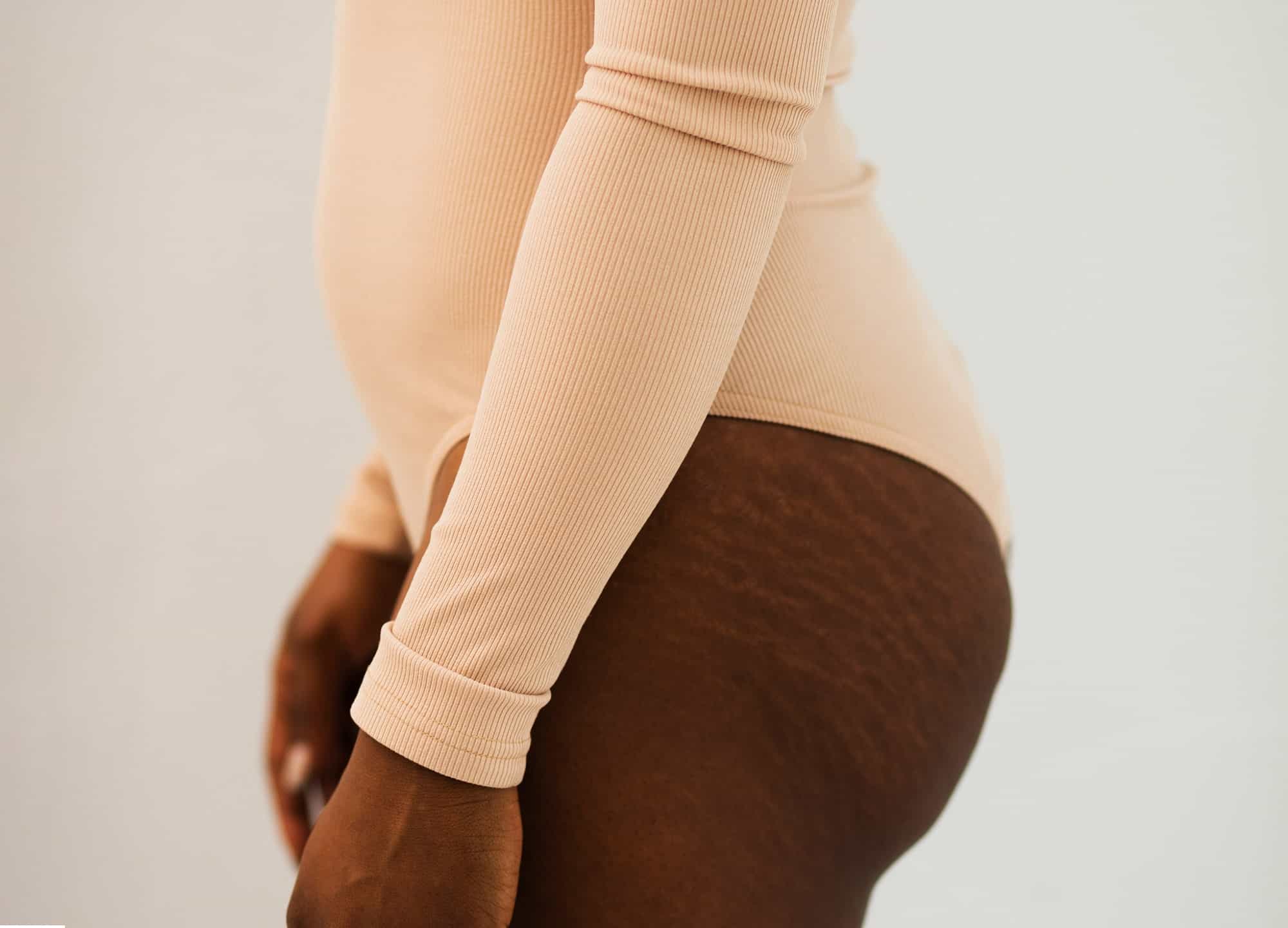 I hated my Brazilian butt lift — and paid $25,000 to have it reversed