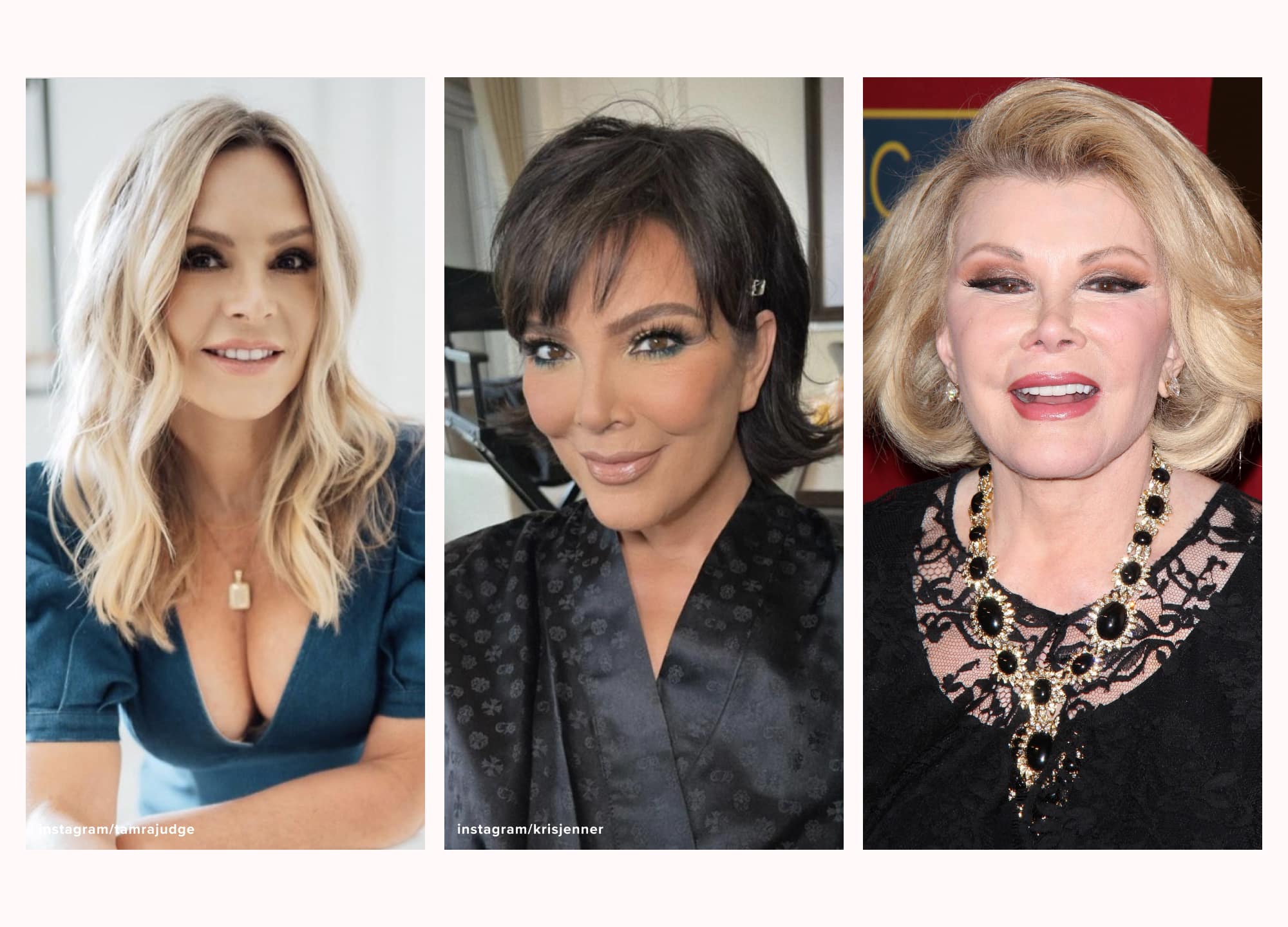What 17 Celebrities Look Like After Their Facelifts
