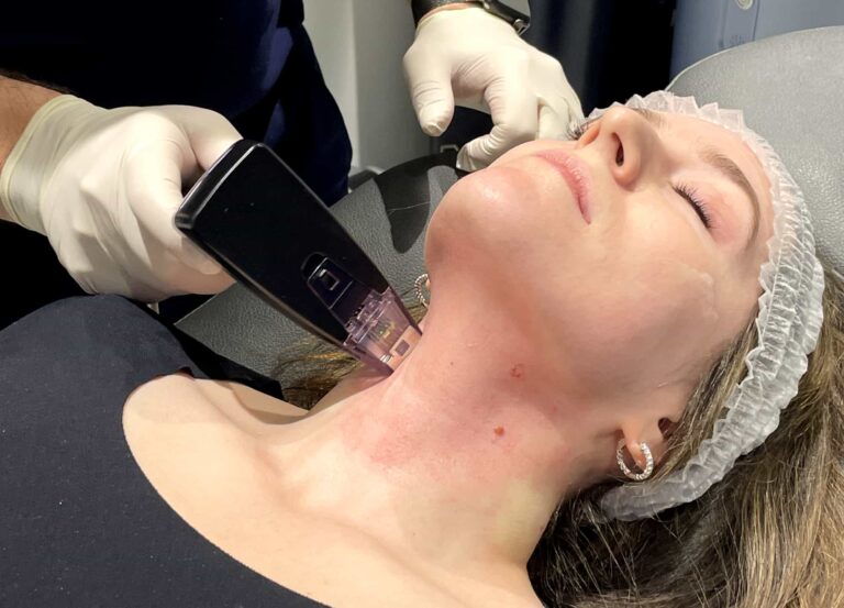 I Got Morpheus8 on My Face & Neck—Here's How It Felt | RealSelf News